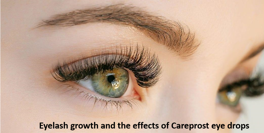 Use Careprost for Eyelash Growth and many other benefits